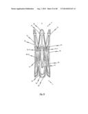 MEDICAL DEVICE FOR TREATING A HEART VALVE INSUFFICENCY diagram and image