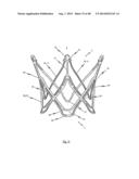 MEDICAL DEVICE FOR TREATING A HEART VALVE INSUFFICENCY diagram and image