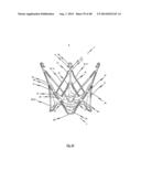 MEDICAL DEVICE FOR TREATING A HEART VALVE INSUFFICENCY diagram and image