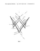 MEDICAL DEVICE FOR TREATING A HEART VALVE INSUFFICENCY diagram and image