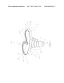 CEMENTLESS TIBIAL IMPLANT diagram and image