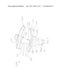 CEMENTLESS TIBIAL IMPLANT diagram and image