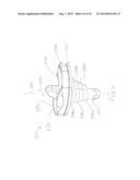 CEMENTLESS TIBIAL IMPLANT diagram and image