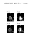 REORIENTATION OF CARDIAC IMAGES diagram and image