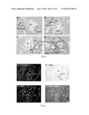 PNMT AS A NOVEL MARKER FOR PROGENITOR CELLS diagram and image