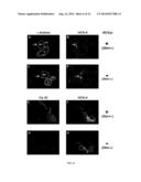 PNMT AS A NOVEL MARKER FOR PROGENITOR CELLS diagram and image