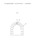 TREATMENT OF TEETH BY ALIGNERS diagram and image