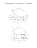 BREAST SUPPORTING GARMENT diagram and image