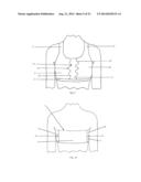 BREAST SUPPORTING GARMENT diagram and image