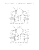 BREAST SUPPORTING GARMENT diagram and image