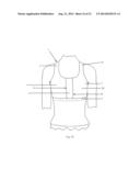 BREAST SUPPORTING GARMENT diagram and image