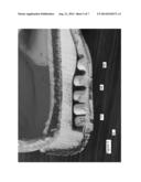 Cushioned Sole with Air Chamber and Resistance Protrusions diagram and image