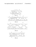 ARTICLE OF FOOTWEAR WITH MULTI-LAYERED SUPPORT ASSEMBLY diagram and image