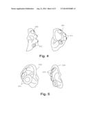 DECORATIVE EAR COVER AND METHOD OF MAKING SAME diagram and image