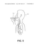 CONTROLLED INHALER FOR DISTRIBUTING INHALANT ACCORDING TO INHALATION     VELOCITY diagram and image