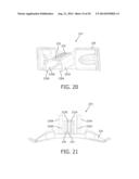 ADJUSTABLE LOCKING FOREHREAD SUPPORT FOR A PATIENT INTERFACE DEVICE diagram and image