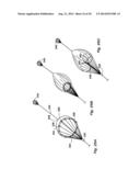 LAUNCH AND RECOVERY SYSTEM FOR UNMANNED AERIAL VEHICLES diagram and image