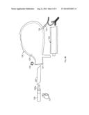 Air Bag Assembly and Tether diagram and image