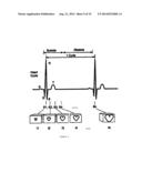 APPARATUS AND METHOD FOR FOUR DIMENSIONAL SOFT TISSUE NAVIGATION IN     ENDOSCOPIC APPLICATIONS diagram and image