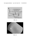 Self-Illuminated Handheld Lens for Retinal Examination and Photography and     Related Method thereof diagram and image