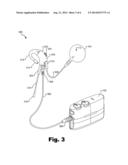 MODULAR ADAPTER ASSEMBLY FOR TELECOIL AND AUXILIARY AUDIO INPUT DEVICE     MIXING diagram and image