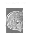 ANTERIOR COMMISSURE AND POSTERIOR COMMISSURE SEGMENTATION SYSTEM AND     METHOD diagram and image