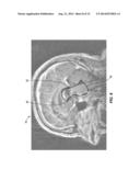 ANTERIOR COMMISSURE AND POSTERIOR COMMISSURE SEGMENTATION SYSTEM AND     METHOD diagram and image