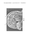 ANTERIOR COMMISSURE AND POSTERIOR COMMISSURE SEGMENTATION SYSTEM AND     METHOD diagram and image