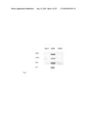 ADJUVANT THERAPY FOR STAPHYLOCOCCAL INFECTION WITH ENTEROTOXIN SPECIFIC     MABS diagram and image