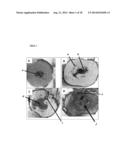 DIAGNOSTIC METHOD AND TREATMENT diagram and image