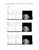 DIAGNOSTIC METHOD AND TREATMENT diagram and image