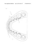 METHOD FOR SHAPING AN ORTHODONTIC WIRE MADE OF A SHAPE-MEMORY MATERIAL,     AND ASSOCIATED WIRE diagram and image