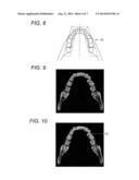 METHOD FOR PERIODONTAL DISEASE MEASUREMENT diagram and image