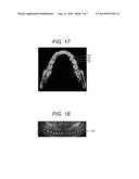 METHOD FOR PERIODONTAL DISEASE MEASUREMENT diagram and image