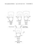 Patient-Specific Dental Prosthesis And Gingival Contouring Developed By     Predictive Modeling diagram and image