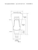 Patient-Specific Dental Prosthesis And Gingival Contouring Developed By     Predictive Modeling diagram and image