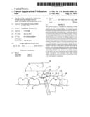 METHOD FOR VALIDATING A DRILLING TEMPLATE FOR PRODUCING AN IMPLANT-BORNE     TOOTH REPLACEMENT diagram and image