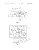 METHOD FOR VALIDATING A DRILLING TEMPLATE FOR PRODUCING AN IMPLANT-BORNE     TOOTH REPLACEMENT diagram and image