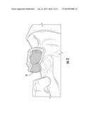 COMPOSITE EDENTULOUS SPACE FILLER FOR DENTAL APPLICATIONS diagram and image