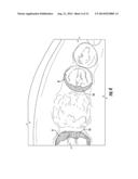 COMPOSITE EDENTULOUS SPACE FILLER FOR DENTAL APPLICATIONS diagram and image