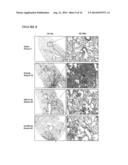 Method for treatment of pulmonary fibrosis diagram and image