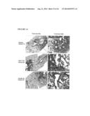 Method for treatment of pulmonary fibrosis diagram and image