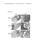 Method for treatment of pulmonary fibrosis diagram and image