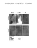 CANCER CELL TARGETING USING NANOPARTICLES diagram and image