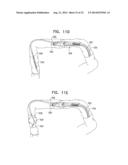 CATHETER INCLUDING A BENDABLE PORTION diagram and image