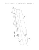 CATHETER INCLUDING A BENDABLE PORTION diagram and image