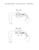 CATHETER INCLUDING A BENDABLE PORTION diagram and image