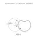 SURGICAL ACCESS SYSTEM AND RELATED METHODS diagram and image