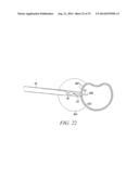 SURGICAL ACCESS SYSTEM AND RELATED METHODS diagram and image