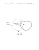 SURGICAL ACCESS SYSTEM AND RELATED METHODS diagram and image